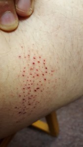 After 30 hours of healing!